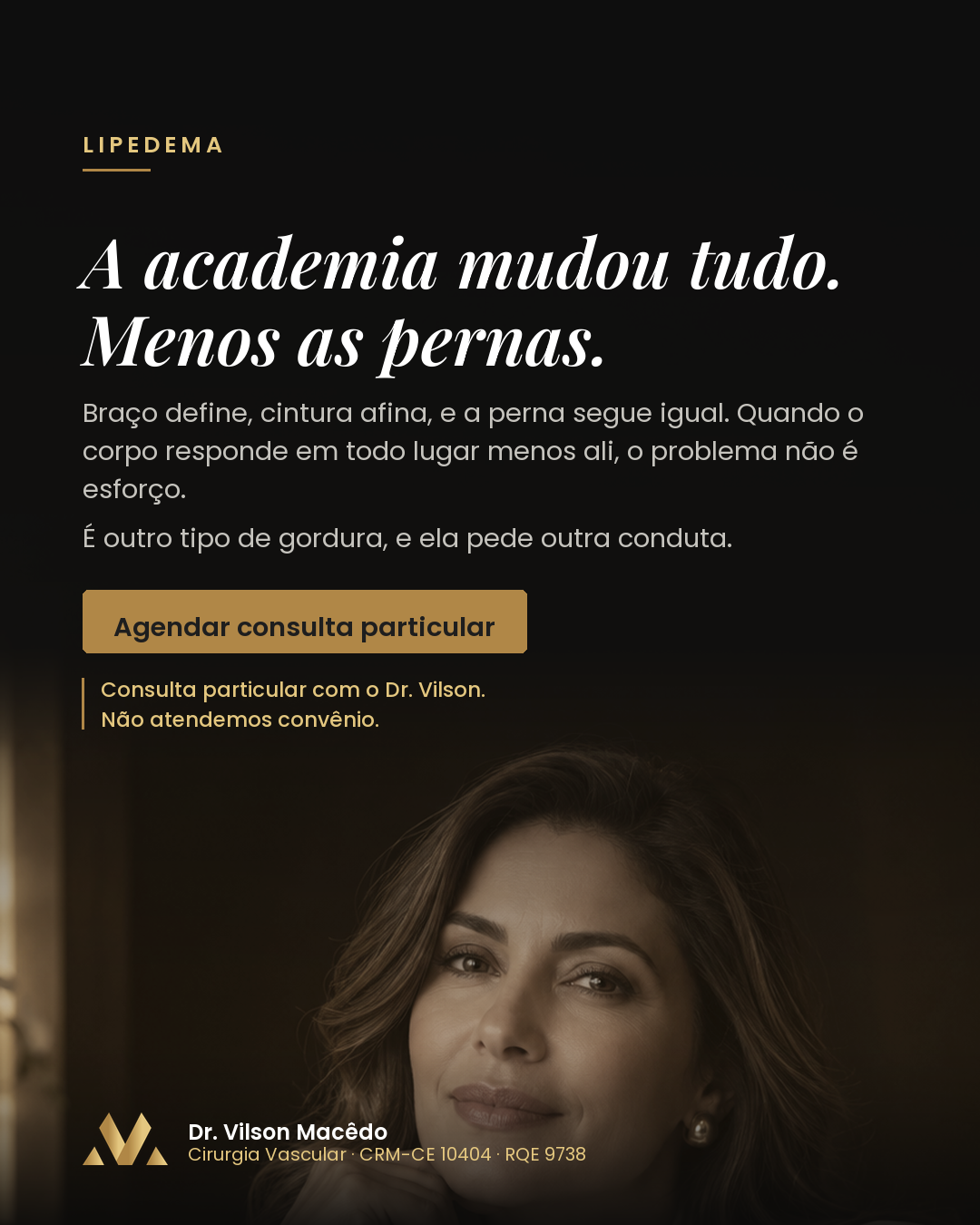 A academia mudou tudo, menos as pernas